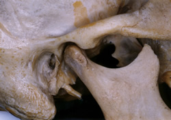 Skelet čelistního kloubu