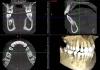 CBCT - Cone Beam Computed Tomography